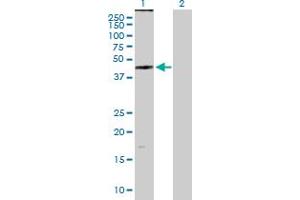 Western Blot analysis of ZDHHC11 expression in transfected 293T cell line by ZDHHC11 MaxPab polyclonal antibody. (ZDHHC11 抗体  (AA 1-412))