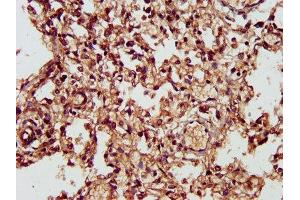 IHC image of ABIN7146680 diluted at 1:300 and staining in paraffin-embedded human lung tissue performed on a Leica BondTM system.