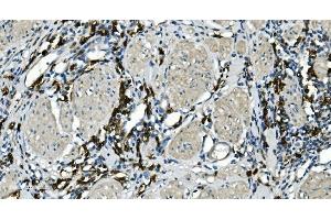 IHC analysis of CD20/MS4A1 using anti-CD20/MS4A1 antibody (ABIN7599233).