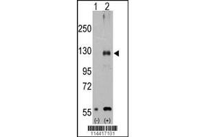 Western blot analysis of TRPM8 using rabbit polyclonal. (TRPM8 抗体  (AA 521-552))