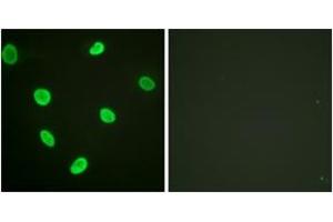 Immunofluorescence analysis of HeLa cells, using Histone H2B (Acetyl-Lys12) Antibody. (Histone H2B 抗体  (acLys12))