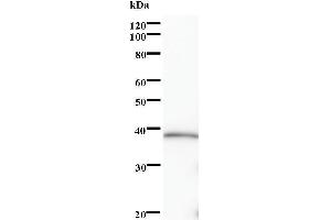 Western Blotting (WB) image for anti-SRY (Sex Determining Region Y)-Box 5 (SOX5) antibody (ABIN932504) (SOX5 抗体)