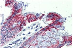 Colon, Human: Formalin-Fixed, Paraffin-Embedded (FFPE) (ACAA1 抗体  (AA 36-85))