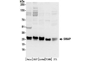 anti-Kinesin Associated Protein 3 (KIFAP3) (AA 125-175) antibody