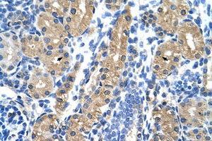 Image no. 1 for anti-Hydroxysteroid (17-Beta) Dehydrogenase 1 (HSD17B1) (N-Term) antibody (ABIN6736344) (HSD17B1 抗体  (N-Term))