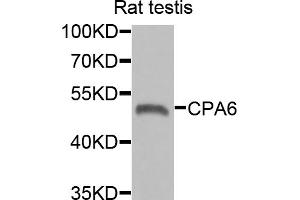 Western blot analysis of extracts of rat testis, using CPA6 antibody (ABIN5975028) at 1/1000 dilution. (CPA6 抗体)