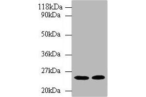 Western blot All lanes: HMGCR antibody at 2 μg/mL Lane 1: Hela whole cell lysate Lane 2: 293T whole cell lysate Secondary Goat polyclonal to rabbit IgG at 1/10000 dilution Predicted band size: 98, 93, 100 kDa Observed band size: 25 kDa (HMGCR 抗体  (AA 588-887))