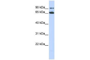 WB Suggested Anti-FZD10 Antibody Titration:  0.