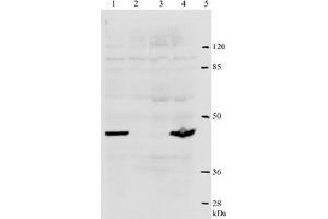 Western Blotting (WB) image for anti-Human Papilloma Virus Type 18 (HPV-18) (AA 1-83), (N-Term) antibody (ABIN781773) (HPV18 抗体  (N-Term))