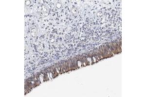 Immunohistochemical staining of human nasopharynx with ANKRD35 polyclonal antibody  shows distinct membranous positivity in respiratory epithelial cells. (ANKRD35 抗体)