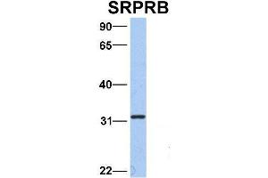 Host:  Rabbit  Target Name:  SRPRB  Sample Type:  Hela  Antibody Dilution:  1. (SRPRB 抗体  (Middle Region))