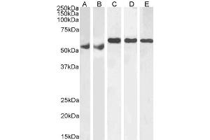 ABIN185160 (1µg/ml) staining of Human Testes (A), Human Ovary (B), Mouse Testes (C), Rat Testes (D) and Rat Ovary (E) lysate (RIPA buffer, 35µg total protein per lane). (KPNA4 抗体  (C-Term))