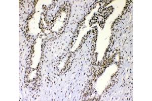 IHC analysis of nmt55/p54nrb using anti-nmt55/p54nrb antibody (ABIN3044530). (NONO 抗体  (N-Term))