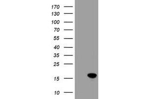 Image no. 2 for anti-Cellular Retinoic Acid Binding Protein 2 (CRABP2) antibody (ABIN1497620) (CRABP2 抗体)