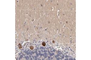 Immunohistochemical staining of human cerebellum with DACT1 polyclonal antibody  shows strong cytoplasmic positivity in purkinje cells. (DACT1 抗体)