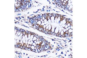Immunohistochemistry of paraffin-embedded Human colon using IC Rabbit pAb (7500) at dilution of 1:100 (40x lens). (ICA1 抗体  (AA 1-160))