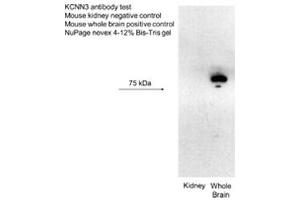 Western Blotting (WB) image for anti-Small Conductance Calcium-Activated Potassium Channel Protein 3 (KCNN3) (C-Term) antibody (ABIN2776146)