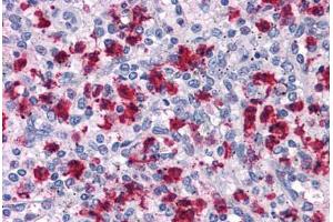 Human Spleen: Formalin-Fixed, Paraffin-Embedded (FFPE) (ARHGAP18 抗体  (C-Term))