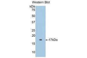 Western blot analysis of the recombinant protein. (IL-2 抗体  (AA 21-153))