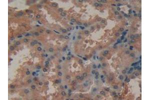 Figure. (MMP12 抗体  (AA 290-469))