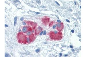 Immunohistochemistry (IHC) image for anti-Phenylalanyl-tRNA Synthetase, beta Subunit (FARSB) (AA 234-342) antibody (ABIN614697) (FARSB 抗体  (AA 234-342))