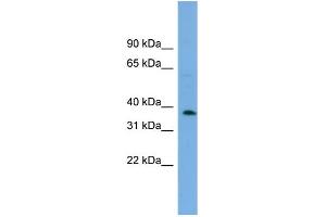 WB Suggested Anti-C17orf48 Antibody Titration: 0. (ADPRM 抗体  (Middle Region))