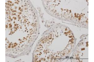 Immunoperoxidase of monoclonal antibody to BOLL on formalin-fixed paraffin-embedded human testis. (BOLL 抗体  (AA 185-283))