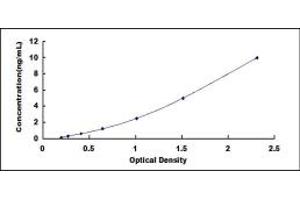Typical standard curve (Retinoic Acid Receptor beta ELISA 试剂盒)
