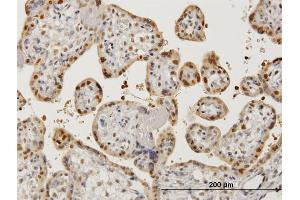Immunoperoxidase of monoclonal antibody to AATF on formalin-fixed paraffin-embedded human placenta. (AATF 抗体  (AA 151-250))