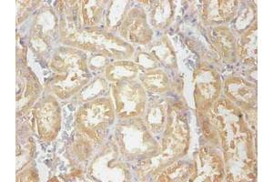 Immunohistochemical of paraffin-embedded human kidney tissue using ABIN7148973 at dilution of 1:200 (CST3 抗体)