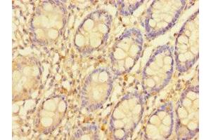 Immunohistochemistry of paraffin-embedded human colon tissue using ABIN7169844 at dilution of 1:100 (SGTB 抗体  (AA 14-304))