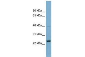 Image no. 1 for anti-Nucleolar Protein 16 (NOP16) (AA 71-120) antibody (ABIN6741999) (NOP16 抗体  (AA 71-120))