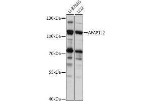 Western blot analysis of extracts of various cell lines, using L2 antibody (ABIN7265382) at 1:1000 dilution. (AFAP1L2 抗体  (AA 1-300))