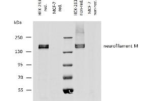 Western blotting analysis of human neurofilament M protein using mouse monoclonal antibody NF-09 on lysates of HEK-293 cell line, and MCF-7 cell line (neurofilament non-expressing cell line, negative control) under reducing and non-reducing conditions. (NEFM 抗体)