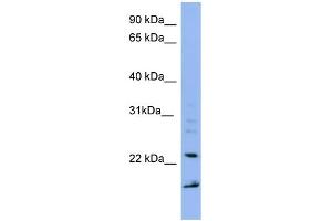 WB Suggested Anti-IMP3 Antibody Titration: 0. (IMP3 抗体  (Middle Region))