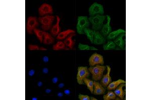 ABIN6260984 and ABIN6278821 staining Hela cells by IF/ICC.