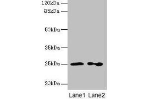 Western blot All lanes: RAB11B antibody at 2 μg/mL Lane 1: Hela whole cell lysate Lane 2: Rat gonadal tissue Secondary Goat polyclonal to rabbit IgG at 1/10000 dilution Predicted band size: 25, 20 kDa Observed band size: 25 kDa (RAB11B 抗体  (AA 2-215))