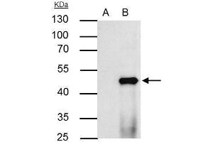 IP Image PPAR alpha antibody immunoprecipitates PPAR alpha protein in IP experiments. (PPARA 抗体  (N-Term))