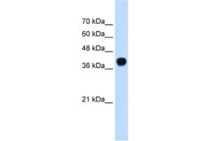 Western Blotting (WB) image for anti-Squalene Epoxidase (SQLE) antibody (ABIN2462528) (SQLE 抗体)