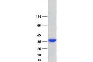 Western Blotting (WB) image for Homer Homolog 2 (HOMER2) (Transcript Variant 3) protein (Myc-DYKDDDDK Tag) (ABIN2722946)