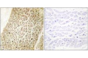 Immunohistochemistry analysis of paraffin-embedded human heart tissue, using AKAP8 Antibody. (AKAP8 抗体  (AA 331-380))