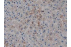 Detection of COMP in Mouse Liver Tissue using Polyclonal Antibody to Cartilage Oligomeric Matrix Protein (COMP) (COMP 抗体  (AA 554-753))