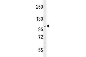 IFT88 antibody western blot analysis in CEM lysate. (IFT88 抗体  (AA 791-820))
