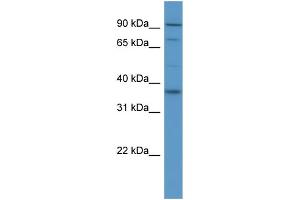 WB Suggested Anti-FGFR2  Antibody Titration: 0. (FGFR2 抗体  (Middle Region))