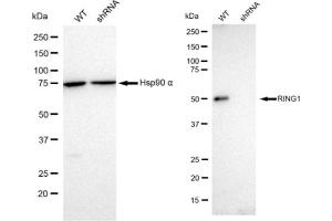 Western blotting analysis using RING1 antibody (ABIN7800240). (Recombinant RING1 抗体)