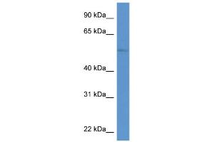 WB Suggested Anti-ZIC3 Antibody Titration:  0. (ZIC3 抗体  (N-Term))