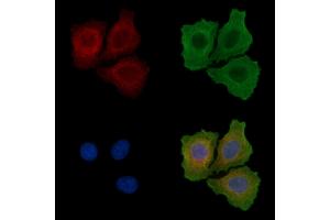 ABIN6255918 and ABIN6267675 staining Hela cells(serum starvation) by IF/ICC. (FRS2 抗体  (pTyr436))