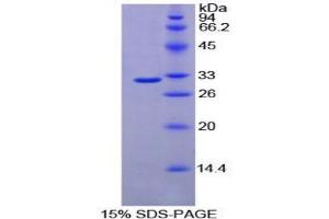 SDS-PAGE analysis of Mouse Fucosyltransferase 4 Protein. (CD15 蛋白)