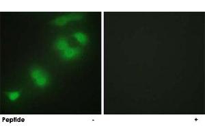 Immunofluorescence analysis of HepG2 cells, using CREBZF polyclonal antibody . (CREBZF 抗体)