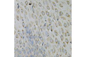 Immunohistochemistry of paraffin-embedded human esophagus using RPLP0 Antibody. (RPLP0 抗体)